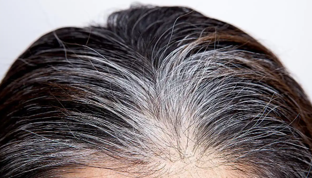 头上有这2种白发，必须排查疾病！很多人都不知道→